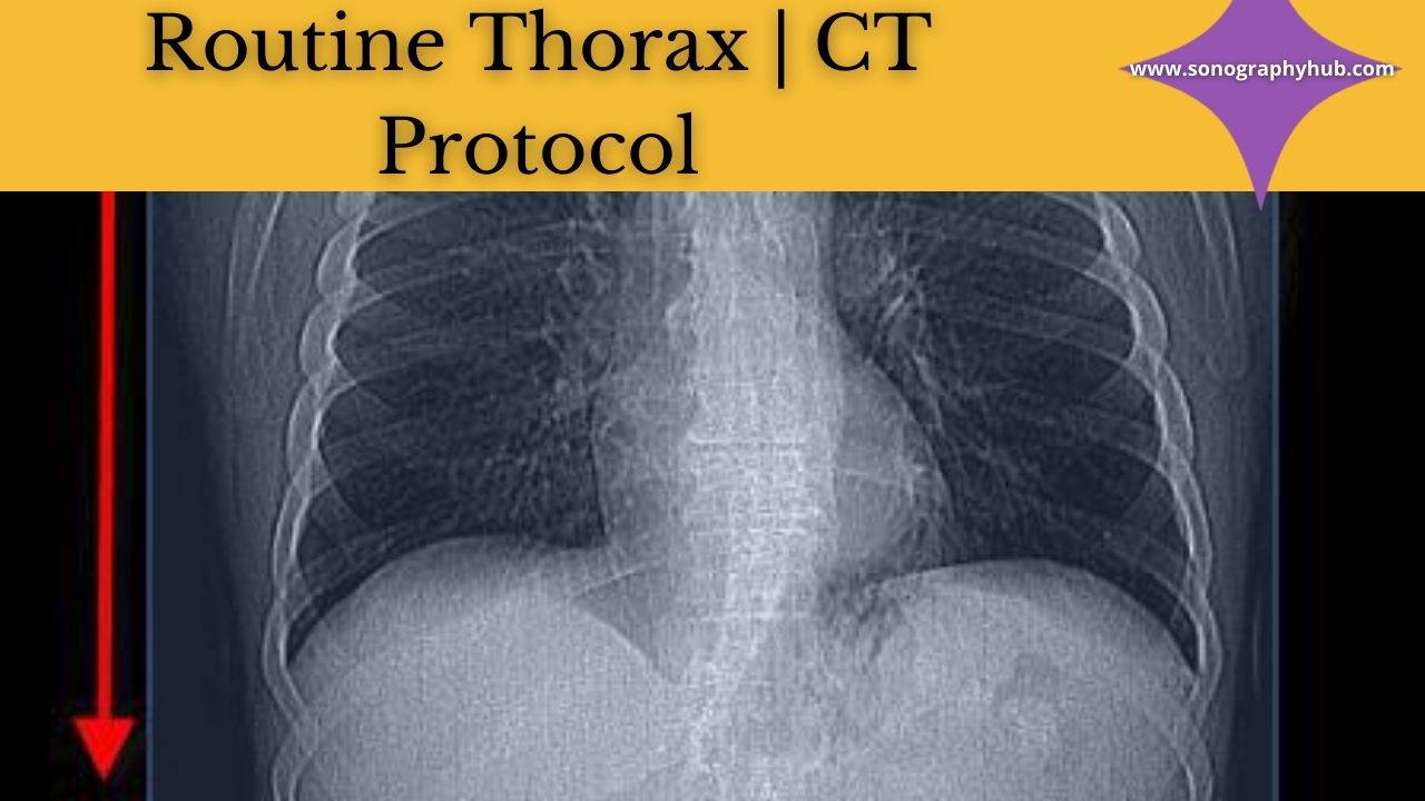 Routine Thorax | CT protocols