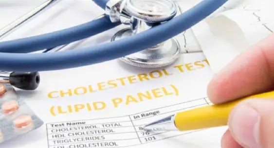 High Cholesterol Just Might Save Your Life