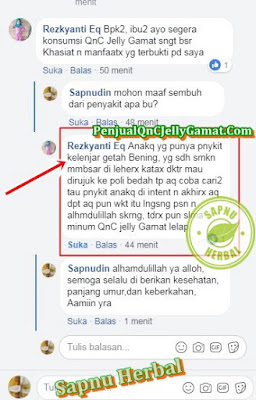 Cara Mengobati TBC Kelenjar Yang Alami Dan Aman Tanpa Efek Samping