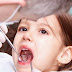 Viêm chân răng ở trẻ- Những thông tin cần biết