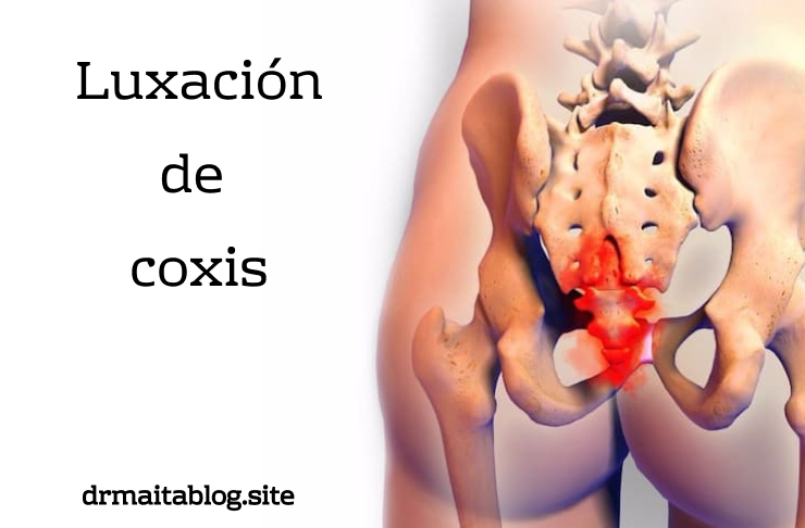 dolor de coxis