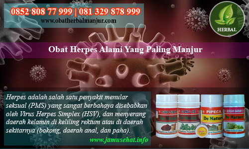 cara menyembuhkan herpes anah