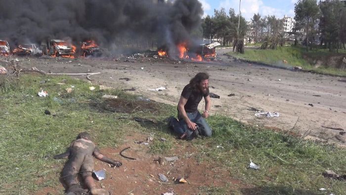 When Life Is Bigger Than A Picture: Photographer Stops Shooting To Save A Badly Injured Child