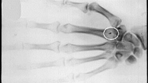 Alien Implants Best Evidence