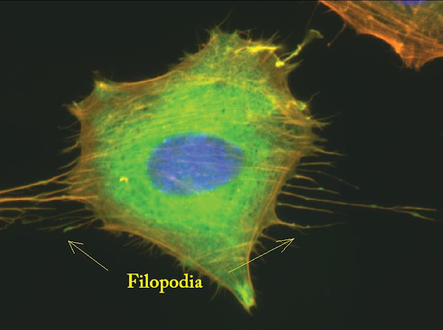 τα κυτταρα ειναι συλλογικοι στοχαστες μελετη kings COllege London, filopodia και κυτταρα μελετη