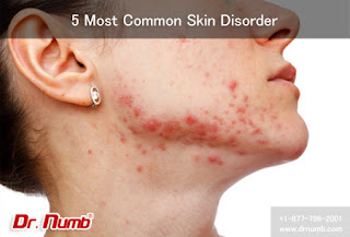 Most Common Skin Disorder