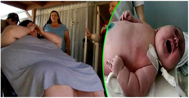 Wanita Ini Dikira Mengandung Anak Kembar 3, Dan Dokter pun Terkejut Ternyata Ini yang Dia Lahirkan !! 