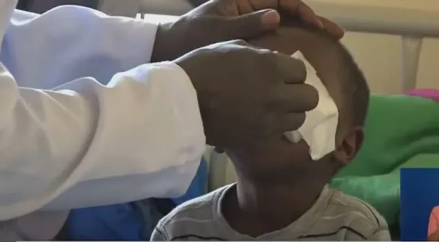 Kisii Boy eyes gouged