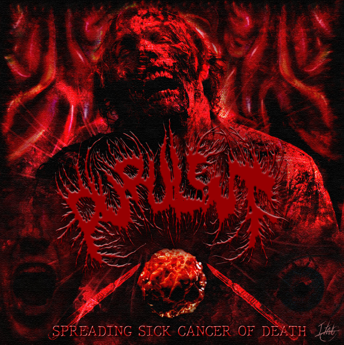 Purulent - Spreading Sick Cancer of Death