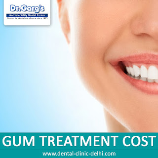 Gum Treatment Cost in India