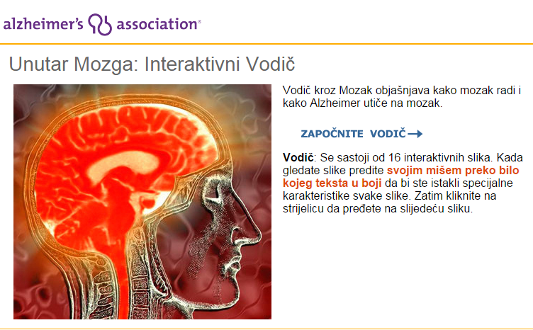  http://www.alz.org/brain_bosnian/