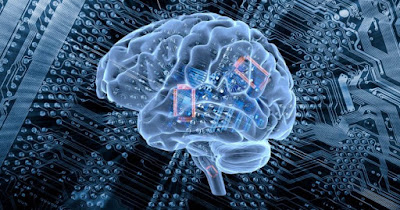Brain Implants Market - TechSci Research