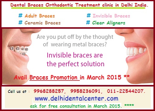 Dental Braces clinic Delhi, Dental Braces Delhi, orthodontist Delhi, Dental Braces in Delhi, Braces Dentist in Delhi, Braces Delhi, Braces Clinic in Delhi, Dental Braces Treatment in Delhi.