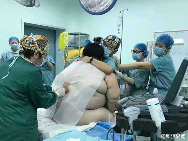 Heavyweight 140Kg Woman Delivers a Healthy Baby 