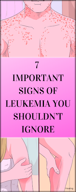 7 Important Signs of Leukemia You Shouldn’t Ignore