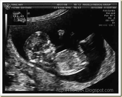 UltraSound011209Scan1