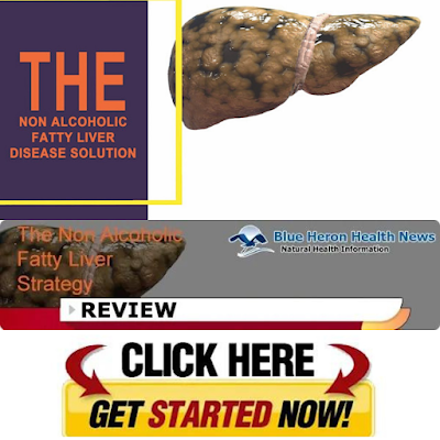 Non Alcoholic Fatty Liver Strategy Review: View These Articles-Offical Store!