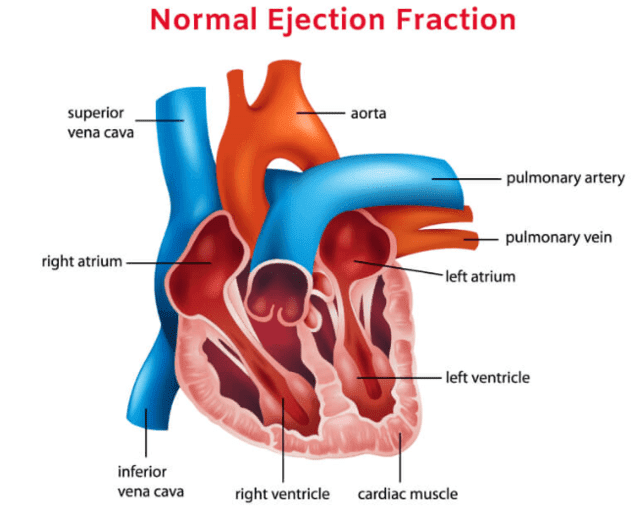 Normal Ejection Fraction By Age