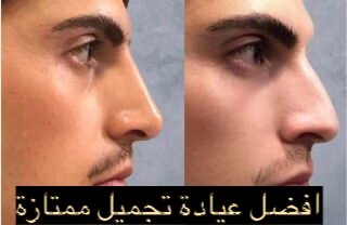 ماهي افضل عيادة تجميل في الامارات 2023 ماهي افضل عيادة تجميل في الامارات 2023