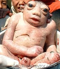 6 Incredible Mutant Babies Pictures Seen on www.VyperLook.com