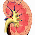 Alterations in Kidney Position and Form