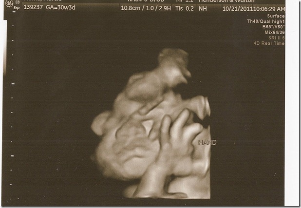 SCAN0068