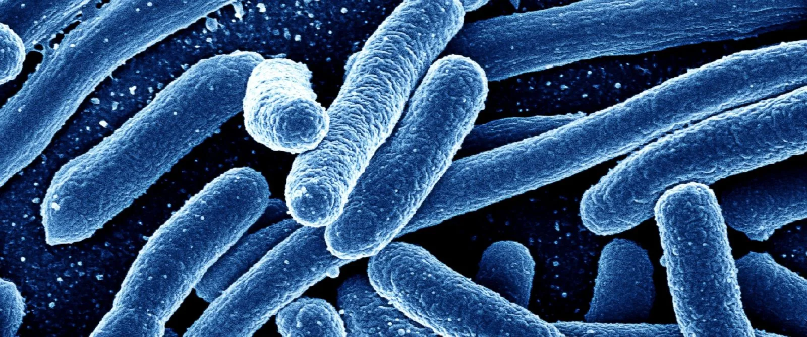 Antidepressants linked to rise in superbugs, study finds