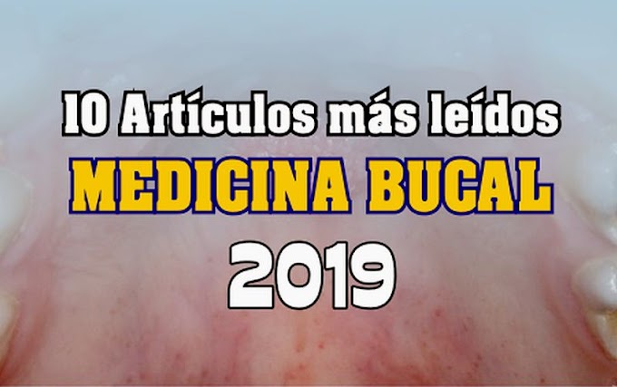 10 Artículos de MEDICINA BUCAL más leídos en el 2019