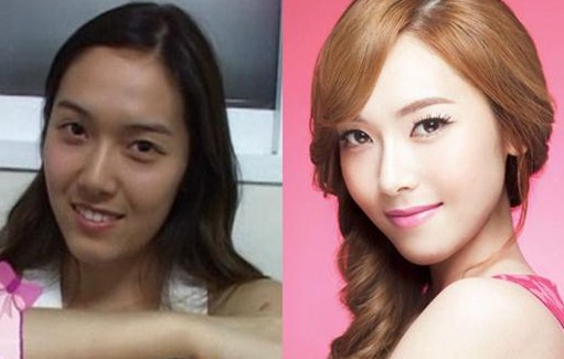 Jessica SNSD Operasi Plastik