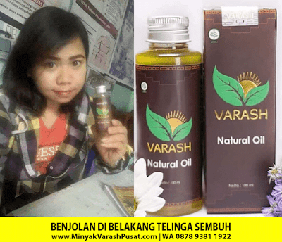 Sesak Nafas Dan Benjolan Di Belakang Telinga Sembuh Berkat Varash