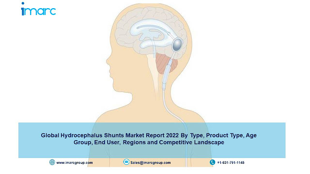 Hydrocephalus Shunts Market In-depth Report 2022-2027, Trends, Top Companies, Business Opportunities, Growth Factors, Competitors Landscape and Other Statistics by IMARC Group