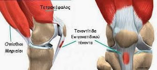 Tendonitis of the patellar tendon