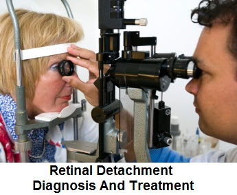 Retinal Detachment: Causes, Symptoms, Diagnosis And Treatment