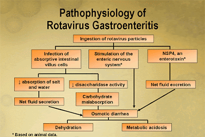 Bacterial Gastroenteritis Update on the management of pediatric acute
otitis media