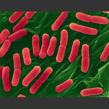 E.COLI OUTBREAK INVESTIGATION