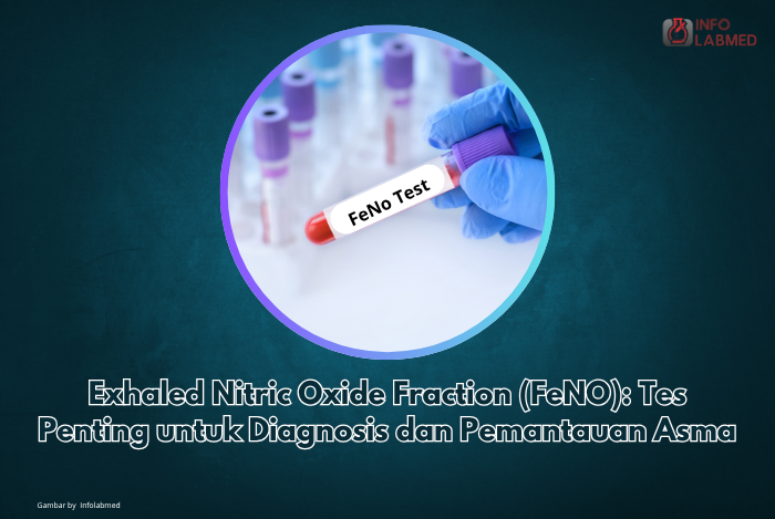 Exhaled Nitric Oxide Fraction (FeNO): Tes Penting untuk Diagnosis dan Pemantauan Asma