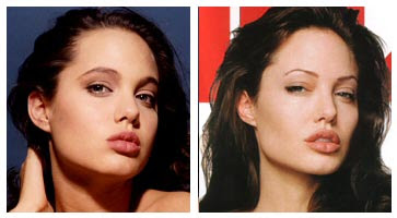 Angelina Jolie Before After