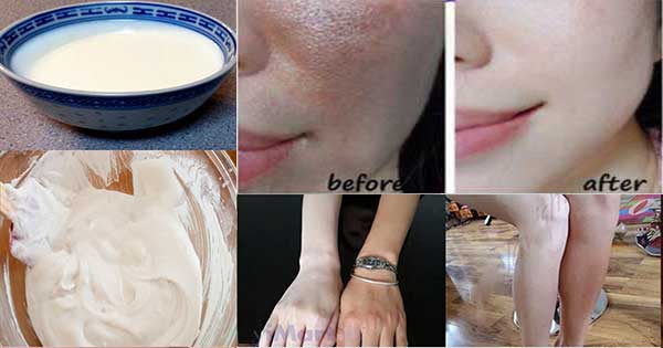 Rub The Lotion Before Sleeping Every Night And Wake Up With Clean And Fair Skin!-