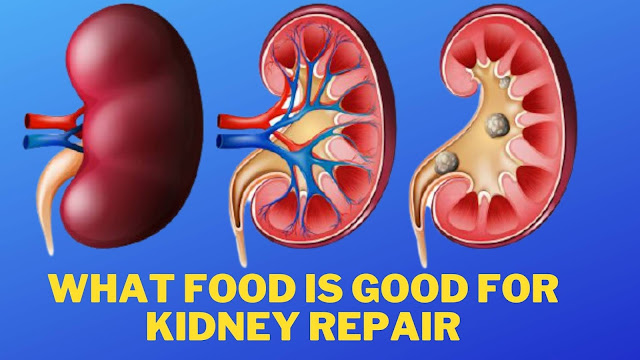 what food is good for kidney repair