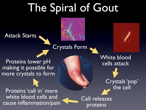 ... Land: Home Remedies for Gout – 12 Natural Solutions by Mike Barrett