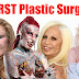 TOP 10 WORST Plastic Surgery DISASTERS