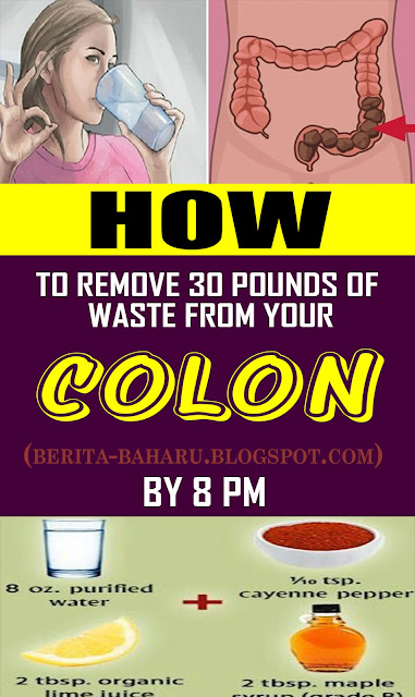 How To Remove 30 Pounds Of Waste From Your Colon By 8PM