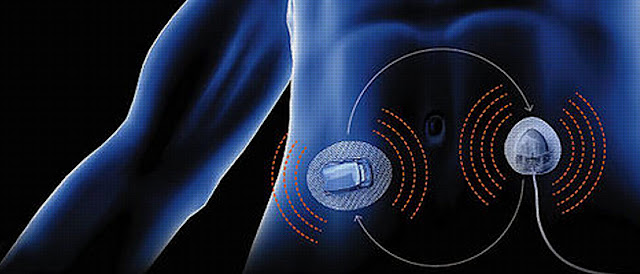 Artificial Pancreas Device System (APDS)