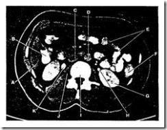 pemeriksaan radiology dengan ct scan