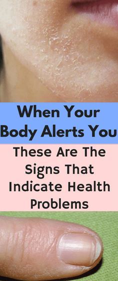 When Your Body Alerts You: These Are The Signs That Indicate Health Problems