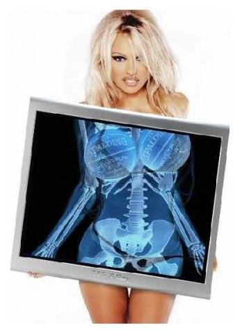 The TSA has apparently leaked Pamela Anderson's fully body scan.