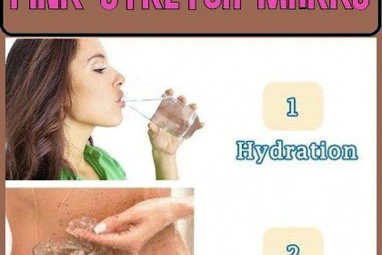 How To Remove Pink or White Stretch Marks Of Your Body