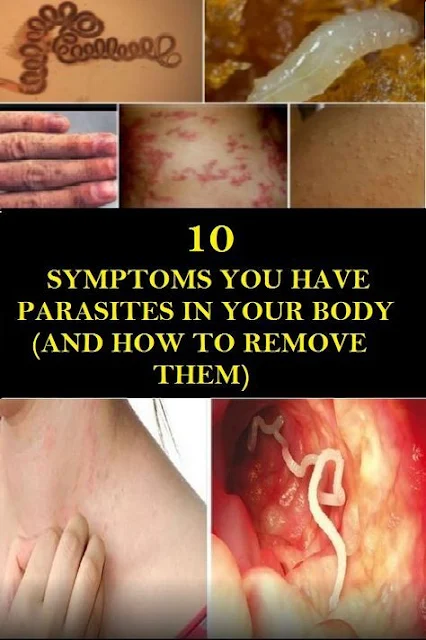 10 Symptoms You May Have Parasites in your Body (and how to remove them)