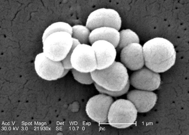 Streptococcus pneumoniae