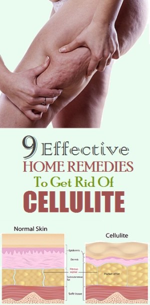 9 Effective Home remedies To Get Rid Of Cellulite Fast
